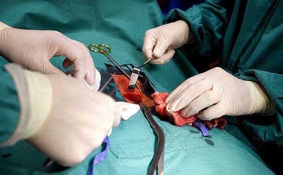 How to Prepare for Pancreatic Cancer Surgery?